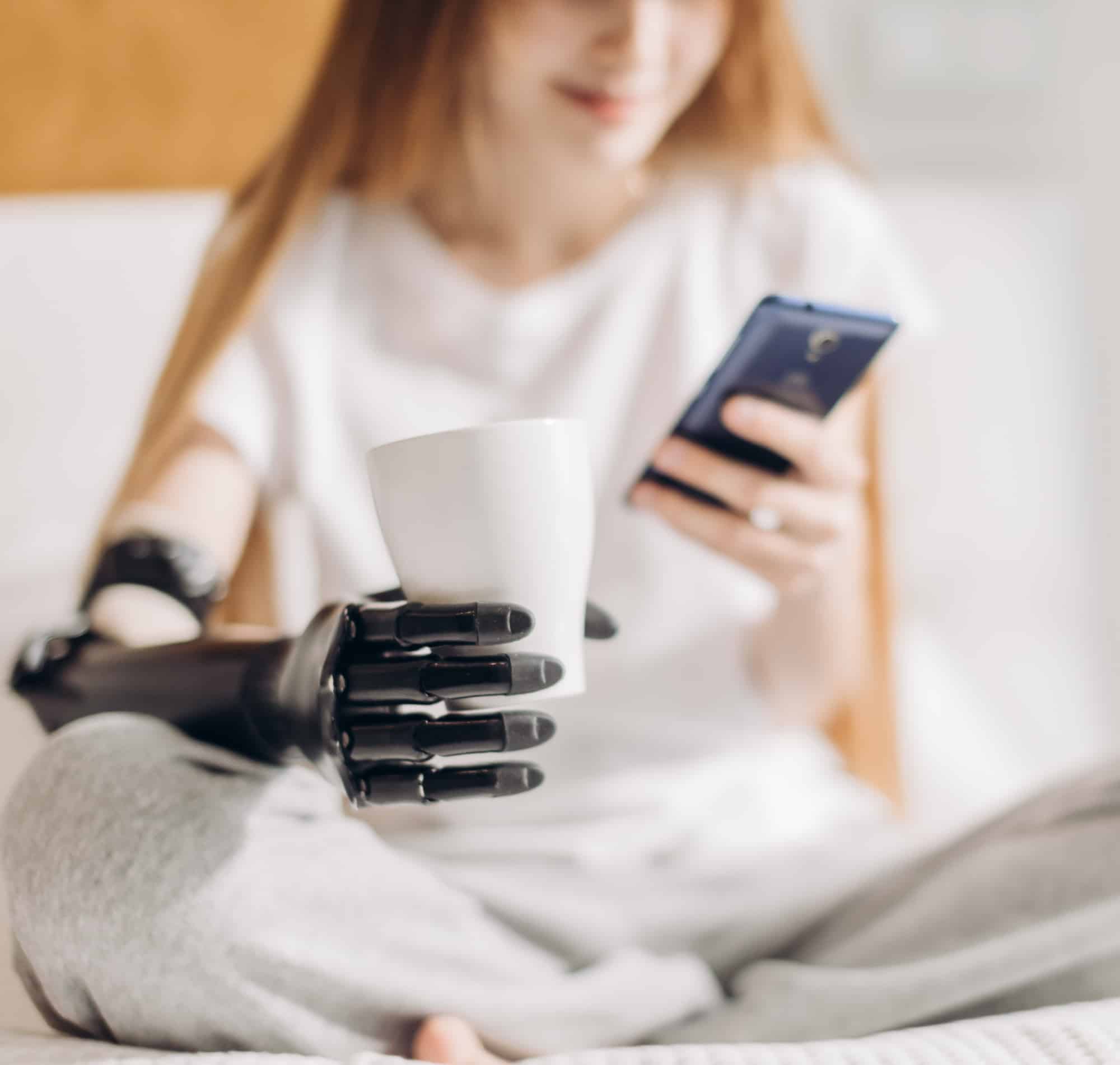 girl with prosthetic hand holding a ceramic mug